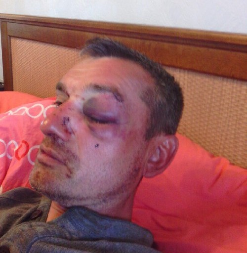 Ciudadano estadounidense torturado por el gobierno de Ucrania