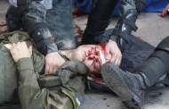 2 Dead , 141 Injured And 10 In Grave Condition From Yesterdays Right Sector Riot In Kiev