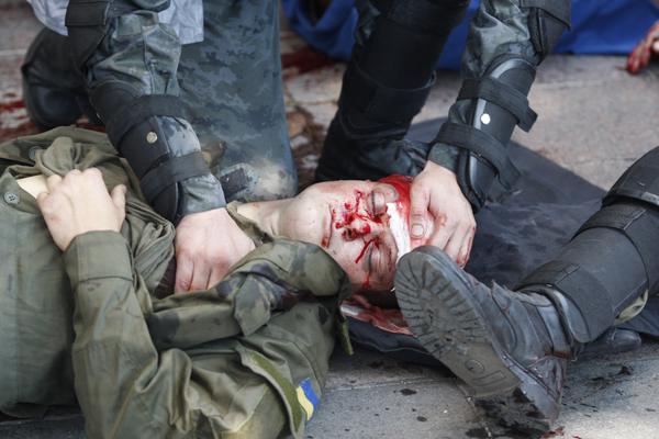 2 Dead , 141 Injured And 10 In Grave Condition From Yesterdays Right Sector Riot In Kiev