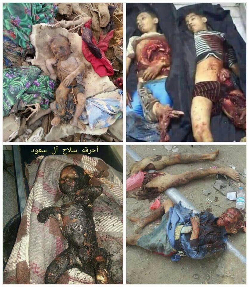War Crimes As U.S. Backed Coalition Kills Children, Saudi Warplanes Strike School Killing 19 In Yemen !