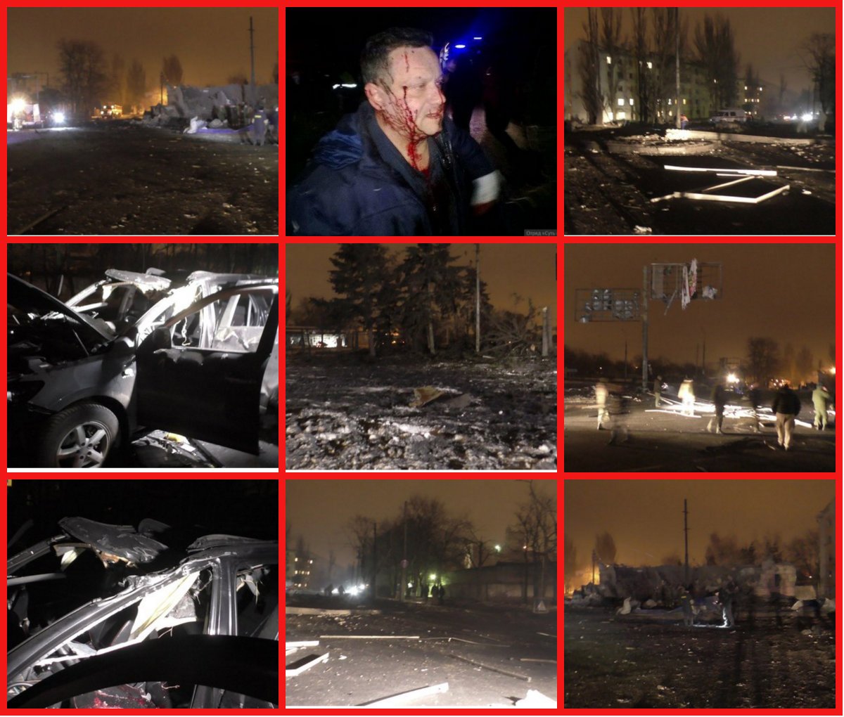 HORROR, WAR CRIMES, GENOCIDE AS THE NAZI UKRAINE JUNTA LAUNCH ROCKETS INTO CIVILIAN AREAS KILLING 2, BADLY WOUNDING MANY INCLUDING CHILDREN ! (Warning Of Video )
