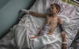 Раненый при обстреле Донецка 4 июня ребенок пошел на поправку
