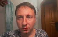 Ukrainian Deputy was beaten in Odessa